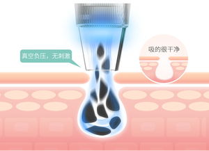 mks美克斯電動毛孔清潔器 告別黑頭粉刺，開啟深層凈澈護(hù)膚時(shí)代